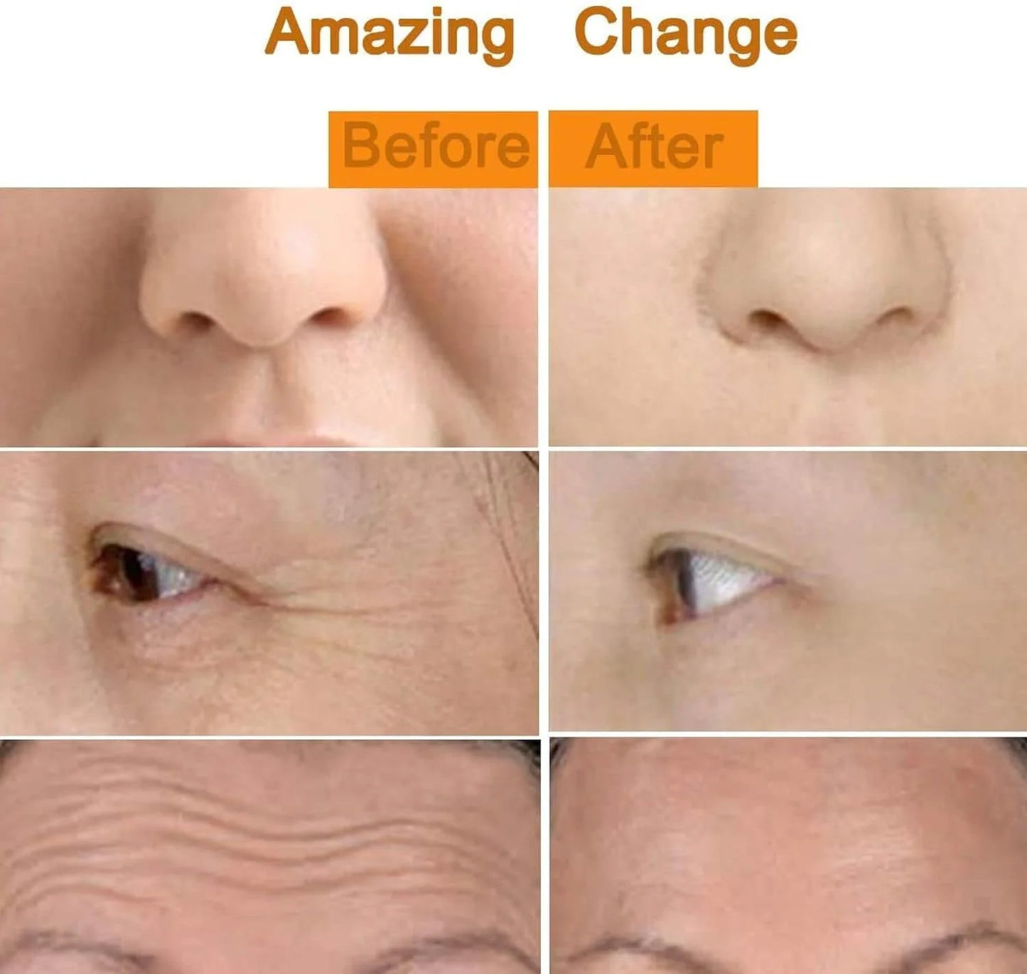 24K Gold T-Shape Vibrating Face Massager Glow Your Skin🌟50% OFF🌟